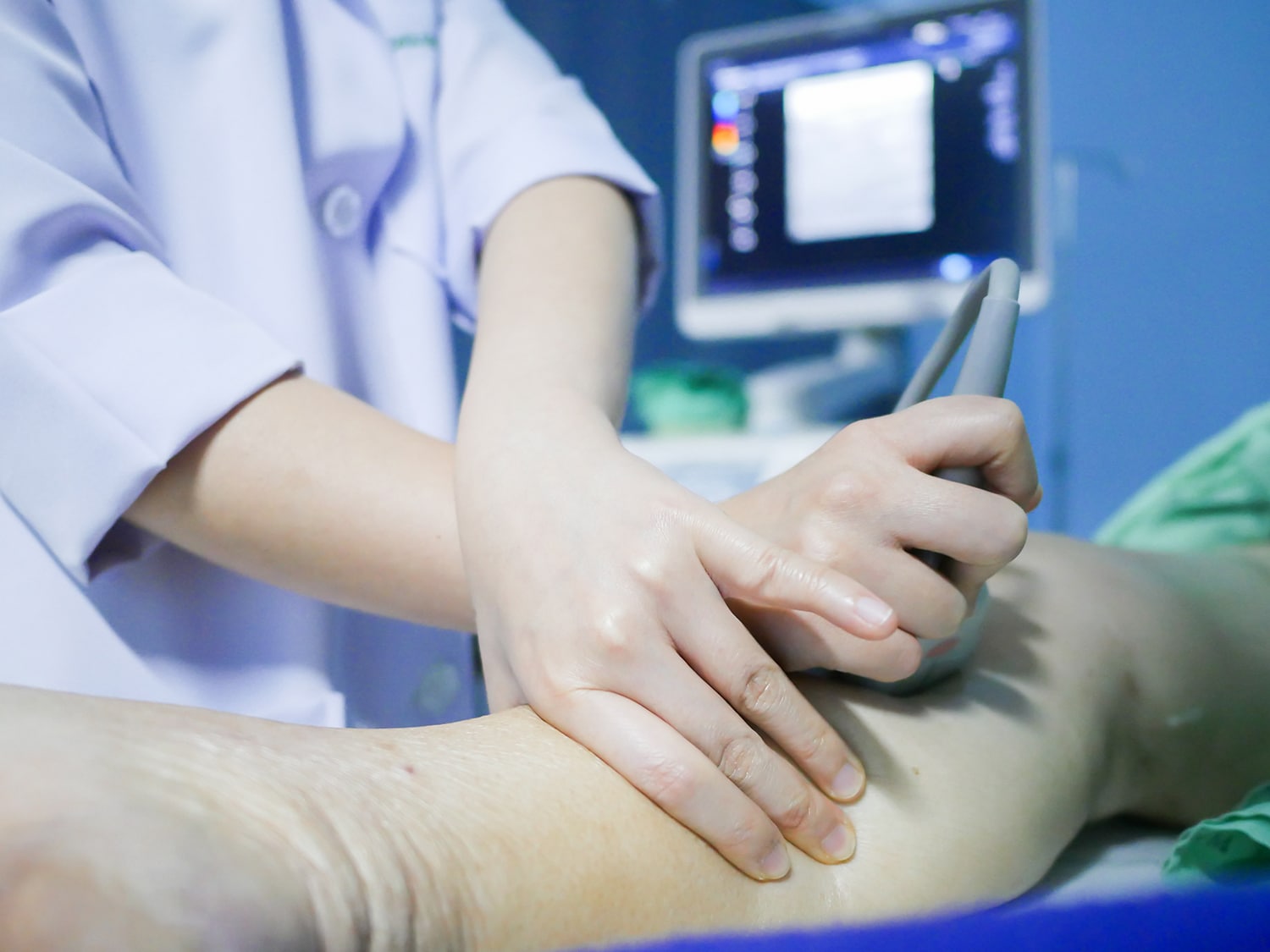 COVID-19 – Prevenção do TEV em pacientes acometidos na UTI