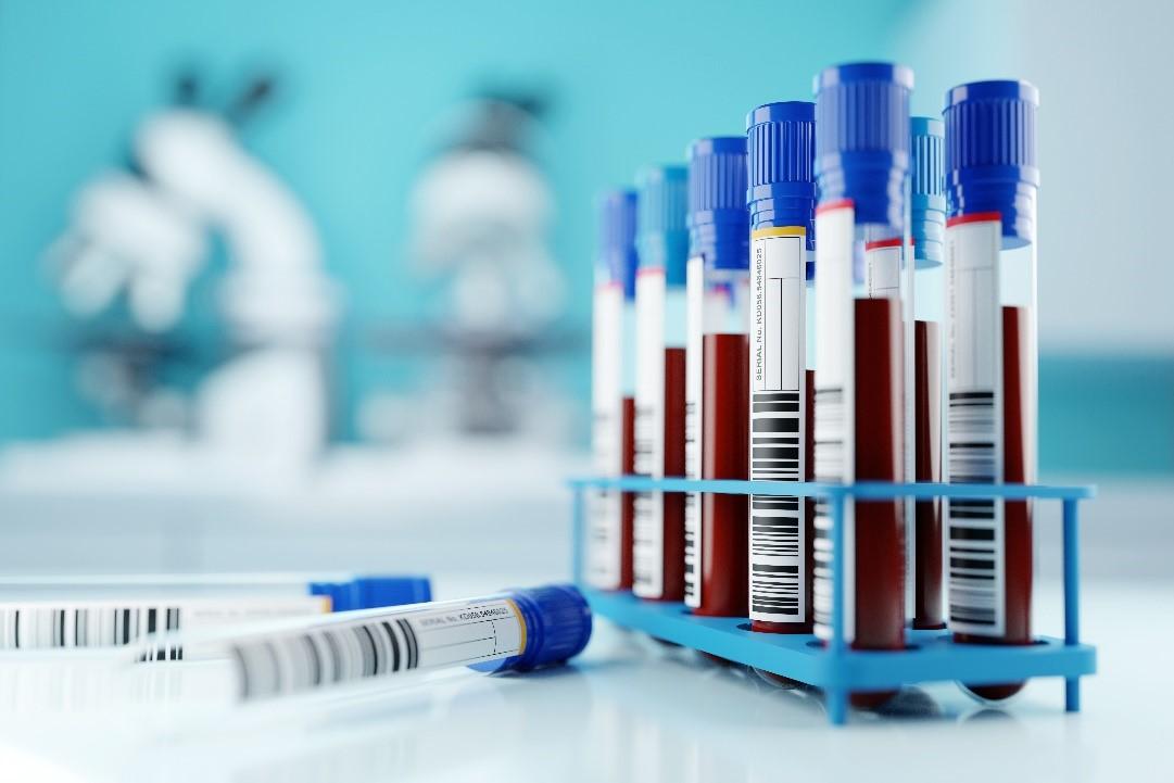 Ferramentas para gerenciamento de risco – Estudo utiliza FMEA para melhorar coleta de sangue