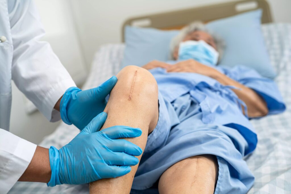 IBSP: Segurança do Paciente - Campanha de melhoria consegue reduzir em até 15% o risco de infecção pós artroplastia