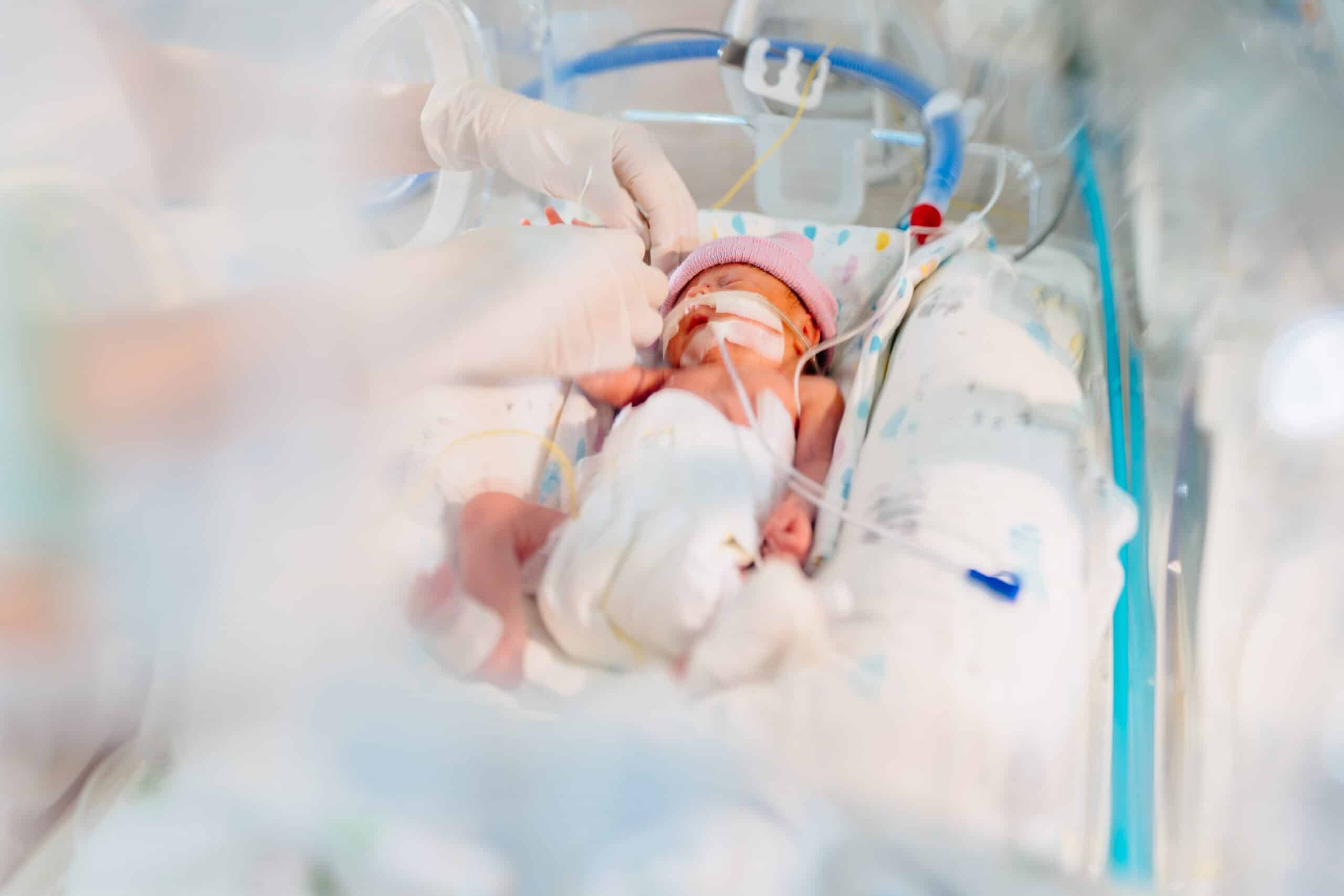 Neonatologia - Prematuros estão mais expostos a eventos adversos nos primeiros dias de internação