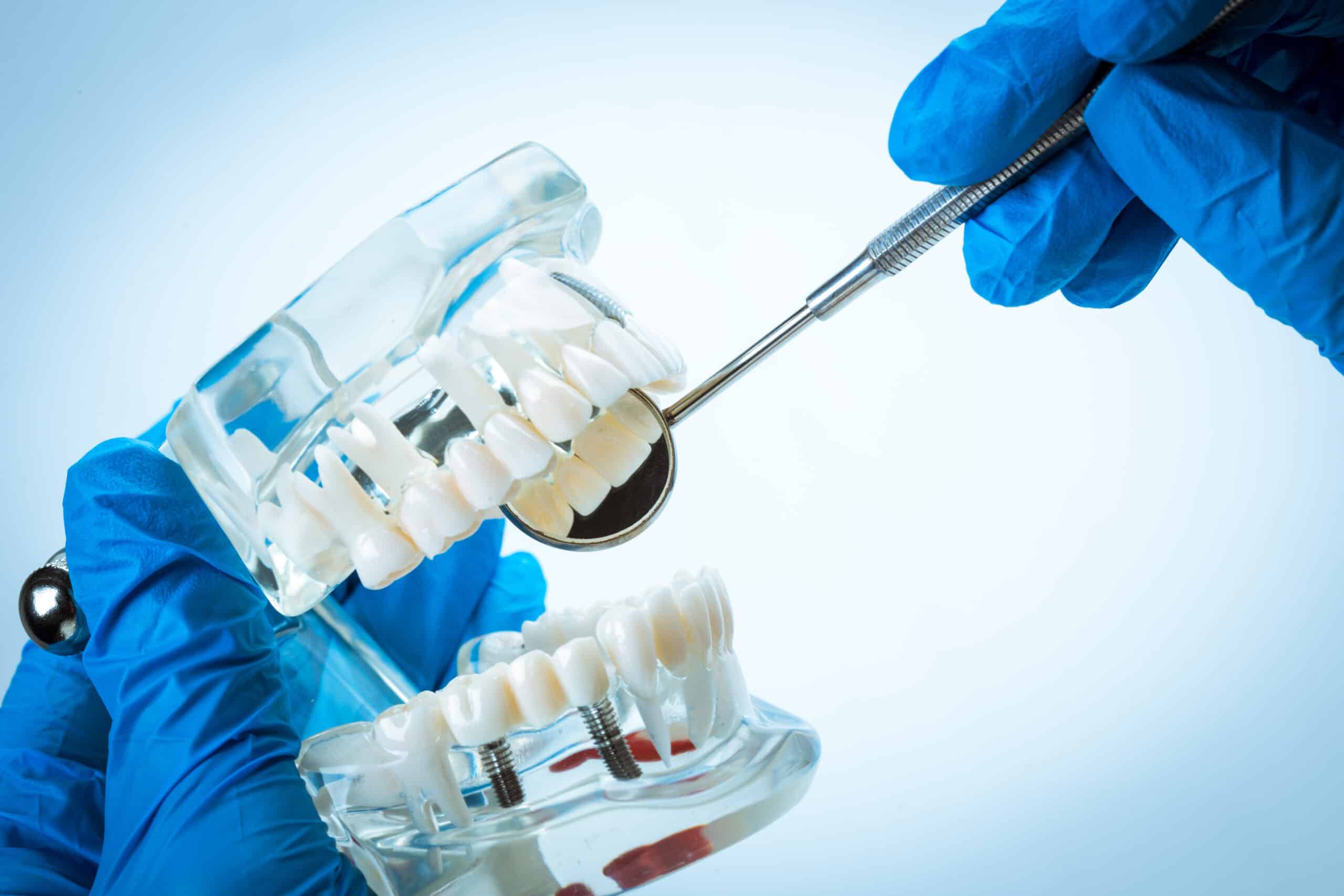 Quando o burnout do cirurgião-dentista se transforma em risco para o paciente